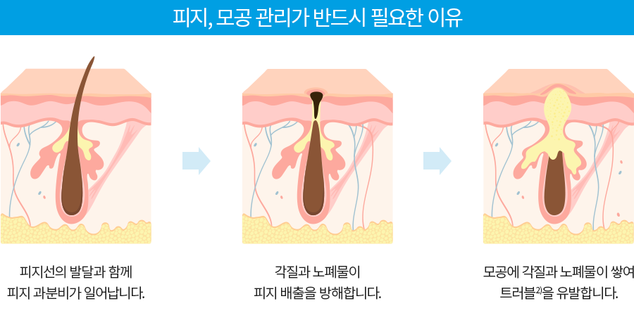 피지,모공관리가 반드시 필요한 이유 1.피지선의 발달과 함께 피지 과분비가 일어납니다. 2.각질과 노폐물이 피지 배출을 방해합니다. 3. 모공에 각질과 노폐물이 쌓여 트러블을 유발합니다.