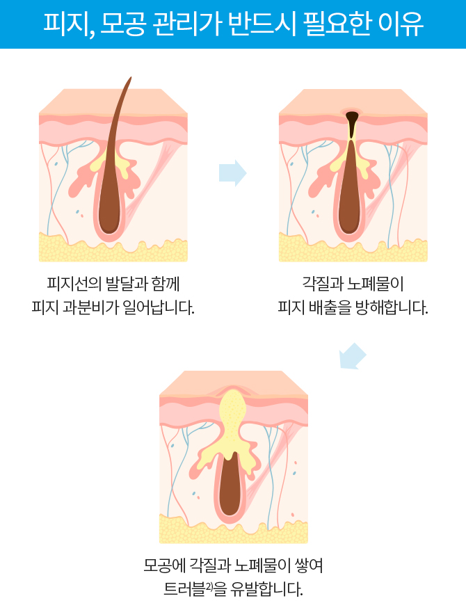 피지,모공관리가 반드시 필요한 이유 1.피지선의 발달과 함께 피지 과분비가 일어납니다. 2.각질과 노폐물이 피지 배출을 방해합니다. 3. 모공에 각질과 노폐물이 쌓여 트러블을 유발합니다.